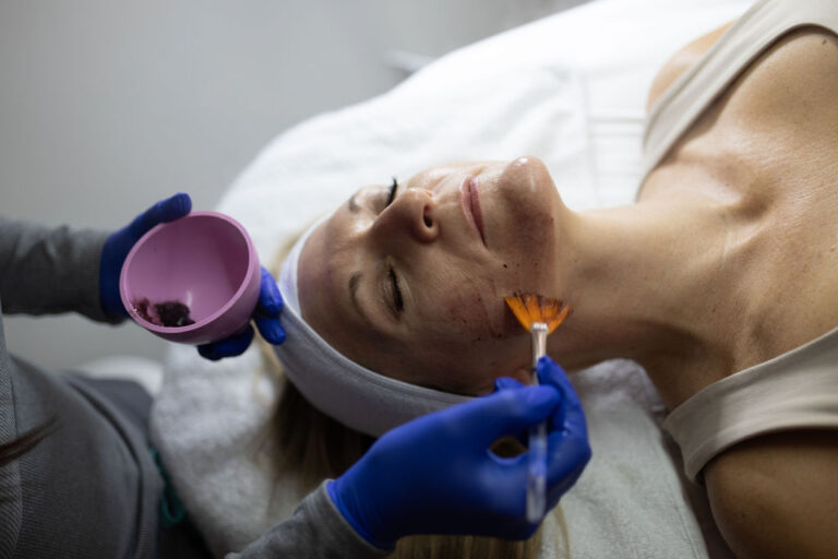 Before and after chemical peel: smoother texture and brighter tone